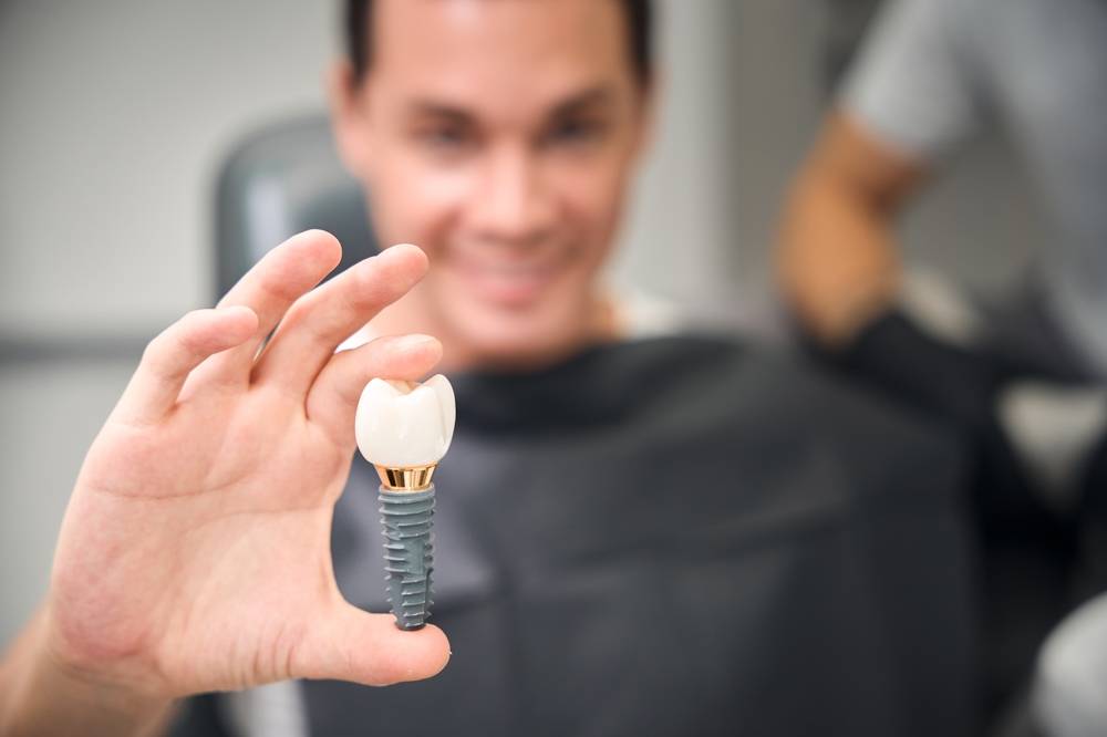 Implantes Dentários: recupere seu sorriso com segurança, conforto e naturalidade